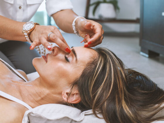 In medicina chinezeasca, acupunctura reduce ridurile si trateaza probleme de piele, concentrandu-se pe modul in care sistemul digestiv si respirator afecteaza pielea.