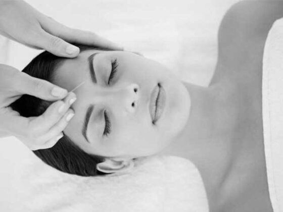 Acupunctura faciala este vazuta ca un facelift nonchirugical si promite sa-ti energizeze tenul in cel mai bun mod!