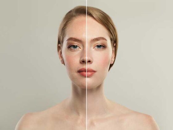 Niacinamida este un ingredient care a intrat incet pe piata beauty, dar are momentul sau acum.