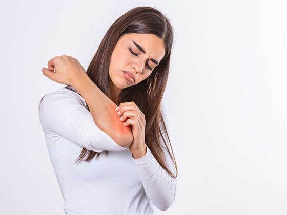 Des intalnite in cazul multor persoane, eczemele reprezinta o adevarata problema, partea buna fiind aceea ca exista astazi remedii pentru a calma o piele sensibila si hidratata.