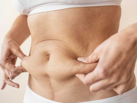 Talia mai marisoara este consecinta grasimii de pe abdomen, care poate creste riscul bolilor de inima, diabetului de tip 2 si accidentelor vasculare cerebrale.