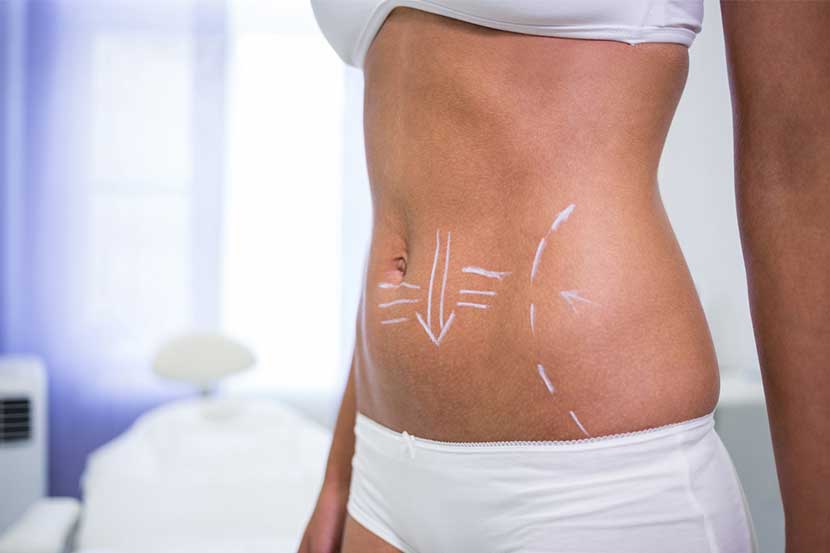 Remodelare corporală oferă mai multe variante, însă este important să ştim ce rezultate vrem să obţinem şi care tehnică este cea mai potrivită pentru fiecare din noi.