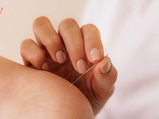 Dintre cele mai importante vindecări alternative putem enumera acupunctura, hipnoterapia, medicina pe bază de plante, masajul.