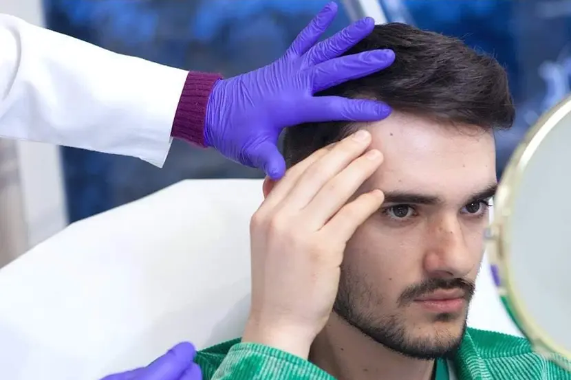 Implantul de păr este singura soluţie eficientă pentru a restabili părul în zonele afectate de alopecie, iar firele de păr implantate nu vor mai cădea din zona tratată.